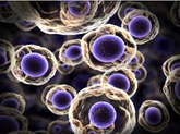 Autologous Stem Cells V13F14 Autologous Stem Cells V13F14