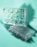 Clinical and real-world data for switching to biosimilars	 Clinical and real-world data for switching to biosimilars