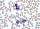 Neutrophils V14J31.jpg Neutrophils V14J31.jpg