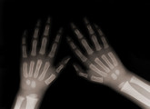 X-ray1 MD001877 V13E03 X-ray1 MD001877 V13E03